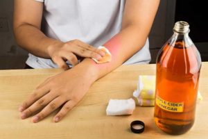 Top 7 Natural Remedies for Allergies Relief: Stop Allergies Symptoms Immediately